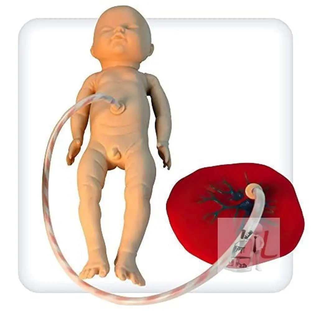 Scifa  Newborn Baby With Placenta 1